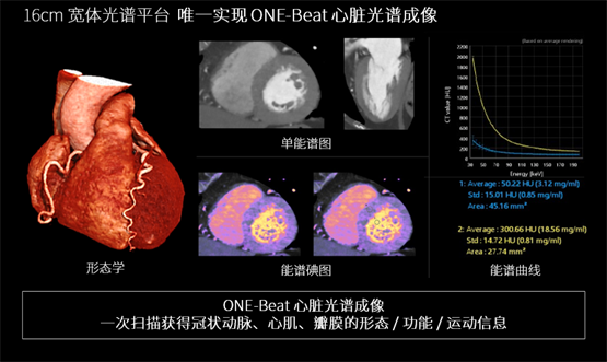 登陆中国，首款16cm光谱成像、超高清宽体CT国产上市(图3)